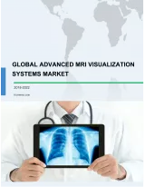 Global Advanced MRI Visualization Systems Market 2018-2022